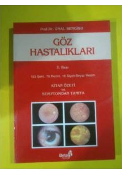 Göz Hastalıkları Ünal Bengisu