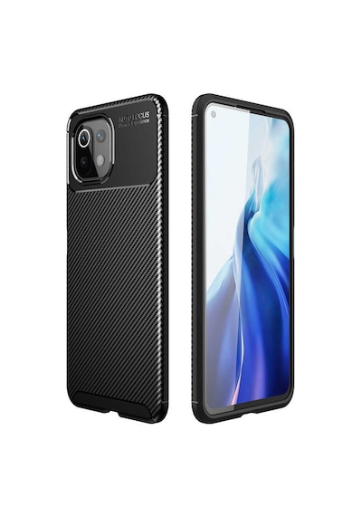 Nettech Xiaomi Mi 11 Lite Uyumlu Auto Seri Arka Koruma Kılıf