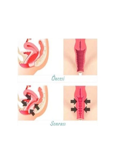 Vagitight Kadınlara Özel Genital Bölge Şekillendirici Krem 100 Ml X 3 Adet
