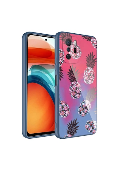 Zore Redmi Note 10 Pro Kılıf Kamera Korumalı Desenli Sert Silikon Omsy Epoksi Kapak - No3