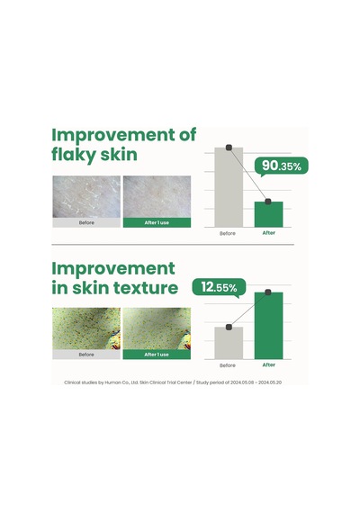 Tr Pha Resurfacing Glow Peel Yüz Peelingi 50 Ml