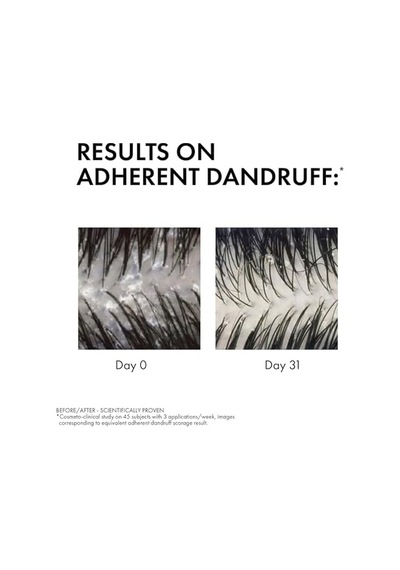 Anti Dandruff Kuru Saçlar İçin Kepek Karşıtı Şampuan 200 Ml