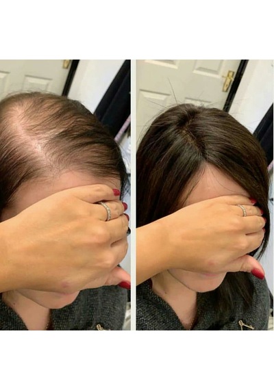 Tepelik.Tığ Işleme Tepelik.Hilly Lace Front Human Hair