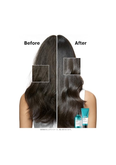 L'oréal Professionnel Paris Serie Expert Scalp Advanced Hassas Saç Derisi Için Profesyonel Şampuan 500ml Diğer