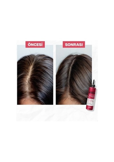 Elma Sirkesi Özlü Tonik 200 Ml Saç Bakımı İçin