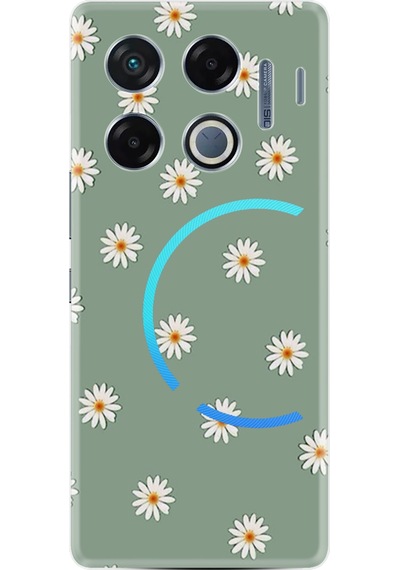 Infinix Gt 20 Pro Kılıf Boutique Baskılı Resimli Yeşil Papatyalar Pcode -041