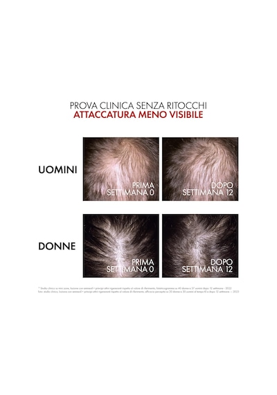 Vıchy Dercos Aminexil Regen Booster Saç Dökülmesine Karşı Bakım Serumu 90 Ml