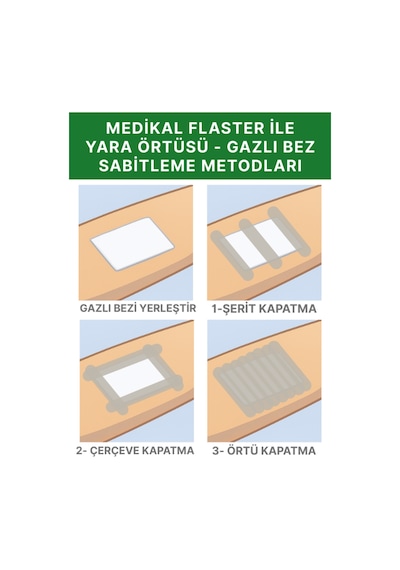 Alban Medikal Sabitleme Flasteri İpek Bant 10 CM x 5 M