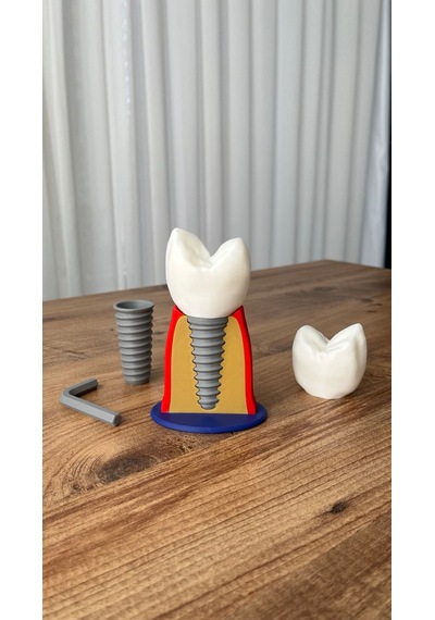 İmplant Modeli Diş Hekimliği Eğitici Model 13 CM