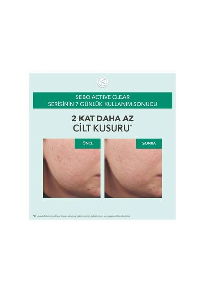 Süksinik Asit & Çinko İçerikli Sebum Dengeleyici Gözenek Sıkılaştırıcı Yüz Serumu - 30 Ml