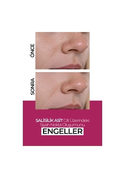 Günlük Kullanım İçin 50 Ml Nemlendirici Krem, Leke Karşıtı Ve Tüm Ciltler İçin