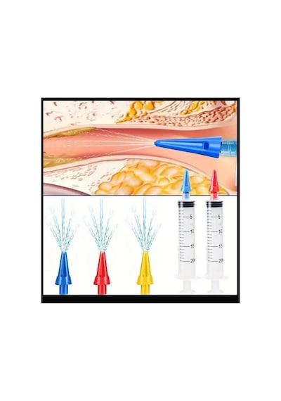 Sıno 3 Delikli Kulak Temizleme Şırınga Kiti, 20ml Manuel Kulak Kiri Temizleme Aracı