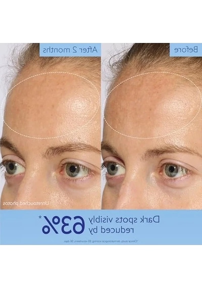 30 Ml Işıltı Verici Leke Karşıtı Serum