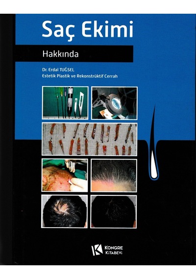 Saç Ekimi Hakkında