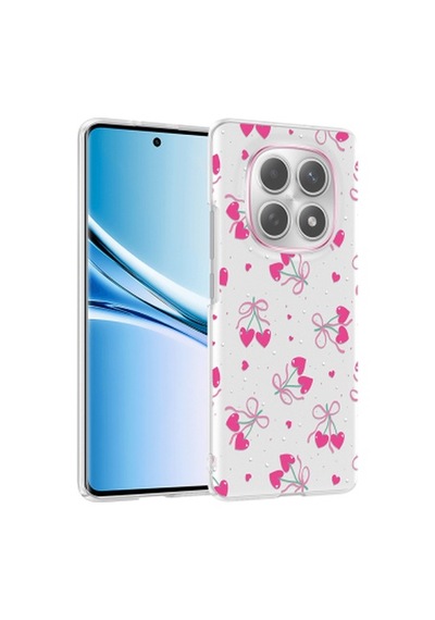 Xiaomi Redmi Note 14 Pro 4g Kılıf Kamera Korumalı Desenli Zore Klip Kapak Xiaomi Redmi Note 14 Pro 4g Zore - Kalpli Kiraz