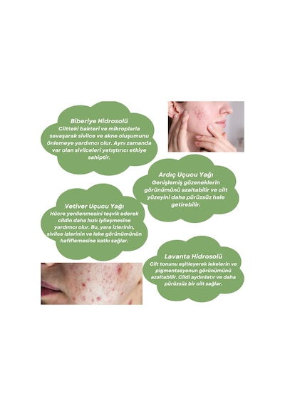 Skin Care Toner - Akneli Ciltler İçin Cilt Bakım Suyu