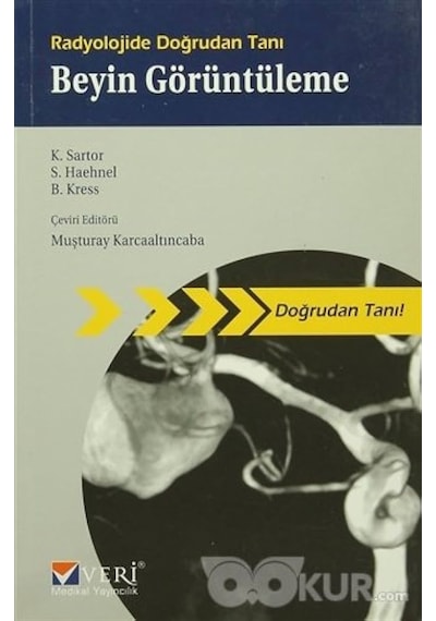 Radyolojide Doğrudan Tanı Beyin Görüntüleme