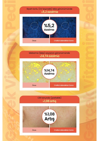 Leke Karşıtı, Aydınlatıcı Cilt Bakım Pedi Telse Red Orange Niacinamide Blemish Pad 70 Pads