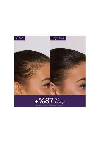 Saç Dökülmesine Karşı Serum 50ml