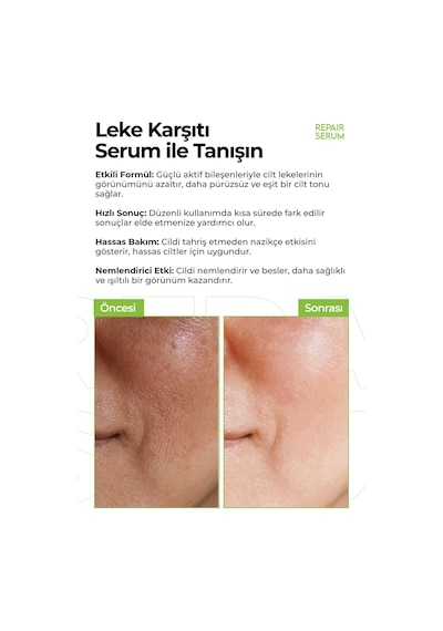 Onarıcı,nemlendirici Ve Aydınlatıcı Repair Serum 50ml