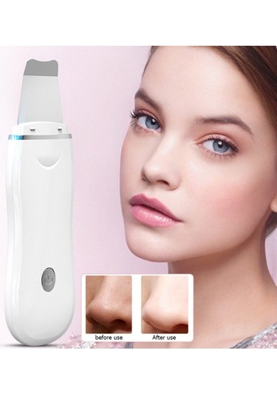 Ultrasonik Cilt Scrubber Akne Ve Siyah Nokta Temizleyici Yüz Peeling Spatula Gözenek Arındırma Aracı 7454