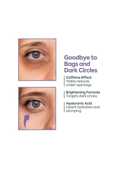 Clasy Care Göz Altı Kremi Morluk Ve Şişlik Karşıtı %5 Kafein +%2 Hyalüronik Asit Kırışıklık, Torba Ve İnce Çizgiler İçin Aydınlatıcı Göz Kremi Kore Esintili Göz Çevresi Kremi, 40 Ml