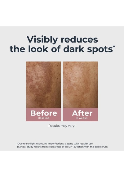 Eucerin Radiant Tone Koyu Leke Karşıtı Yüz Serumu 30ml