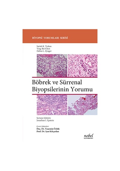 Böbrek ve Sürrenal Biyopsilerinin Yorumu - Satish K. Tickoo -  Ying-Bei Chen - Nobel Tıp Kitabevleri