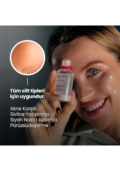 Akne Karşıtı Losyon 30 Ml