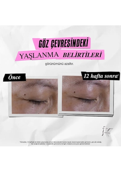 Ciltteki Kırışıklık, Yaşlanma Ve Leke Görünümünü Hedef Alan Yenileyici Göz Kremi 28 Ml