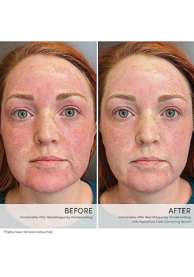 Iredale Hydropure Correcting Serum