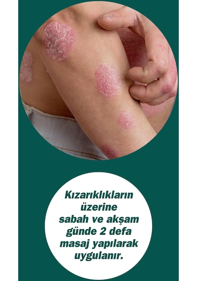 Dermodicos Krem 30 Ml Çay Ağacı Yağı / Tea Tree Oıl