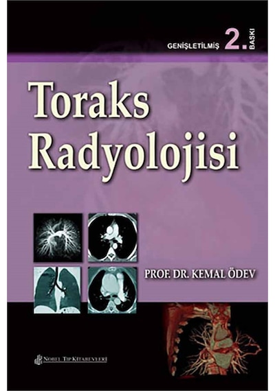 Toraks Radyolojisi- Nobel Tıp Kitabevleri