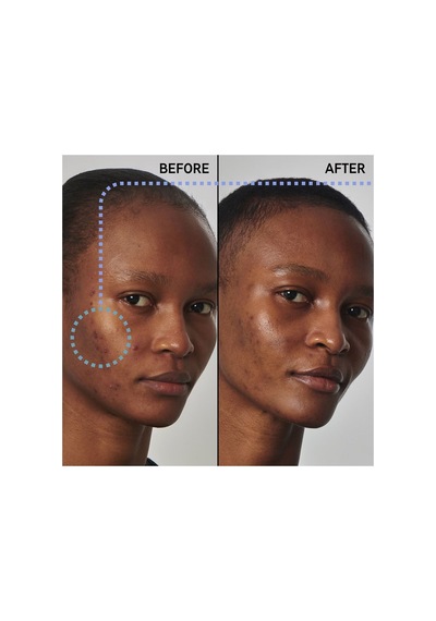 The Inkey List Excess Oil %20 Niacinamide Yüz Serumu 30 Ml