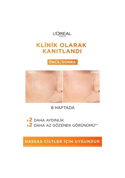 L'Oréal Paris Revitalift Clinical %12 Saf C Vitamini Aydınlatıcı Serum &cilt Yenileme Etkili Temizleme Jeli 150 Ml pktrvtcvtglklkjl-9576
