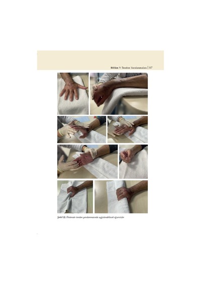 El Hastalıkları Ve Rehabilitasyonu