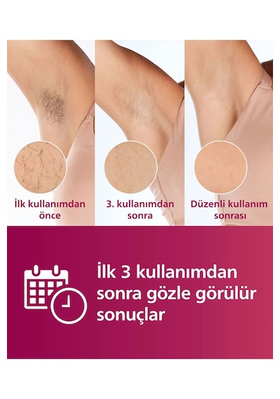 Philips Lumea Prestige Premium Ipl Lazer Epilasyon Full Set