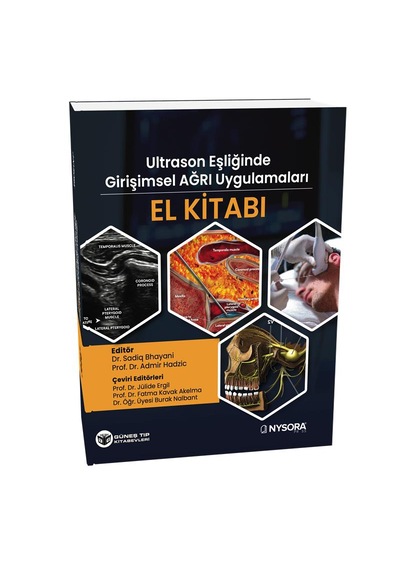 Nysora - Ultrasn Eşliğinde Girişimsel Ağrı Uygulamaları El Kitabı Video Destekli
