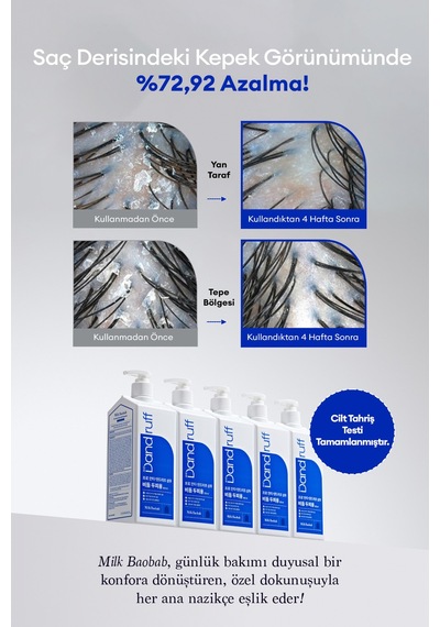 Derinlemesine Arındırıcı Kepek Şampuanı Mılk Baobab Pro Anti-dandruff Shampoo Tüm Saç Tipleri