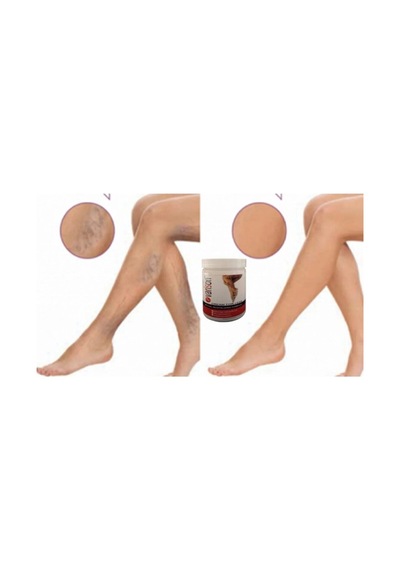 Varison Bacak Bakım Kremi 200 Ml X 2adet