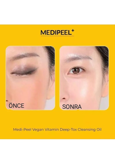 Medipeel Vegan Vitamin Deep-tox Temizleme Yağı, 200 Ml