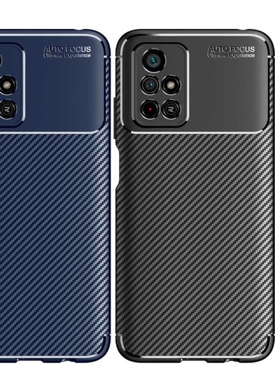 Xiaomi Redmi Note 11T 5G Kılıf Zore Negro Silikon Kapak-Siyah