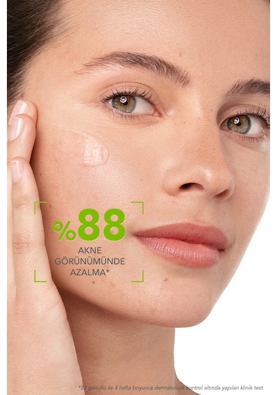 Bioderma Sebium Yağlı ve Akneli Ciltler İçin Sivilce Karşıtı Serum 30 ML