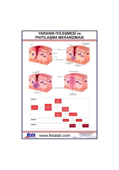 Yaranın Iyileşmesi Eğitim Levhası