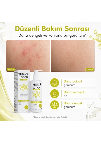Thol's Scabthol Kükürtlü Vücut Losyonu 200 ML