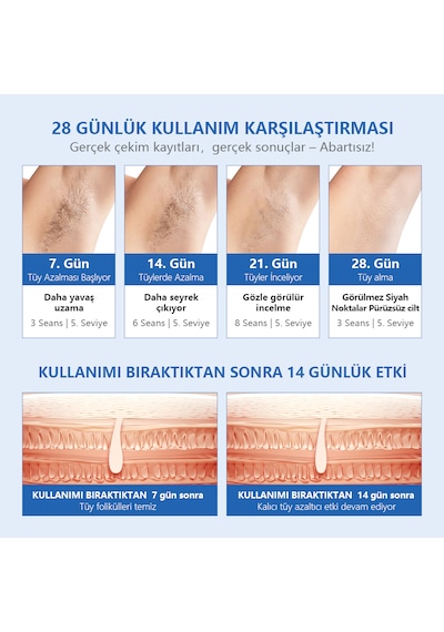Mavi Yeni Seri Mlay T16 1 Milyon Atım Standart Versiyon Epilasyon Cihazıcihazı Hr