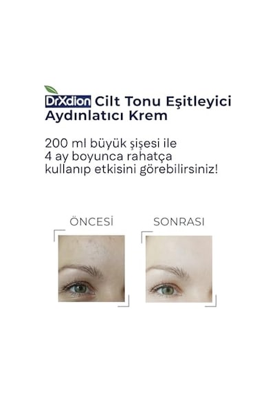 Karşıtı Aydınlatıcı Krem Niacinakarın Bölgesi Arbutin Vitamin C Kojic Asit Ferulic Asit B5 Vitamini Kolajen Içe