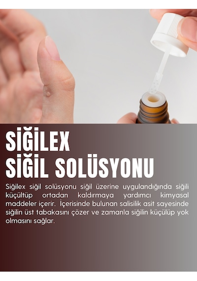 Siğilex Siğil Solüsyonu 15 ML