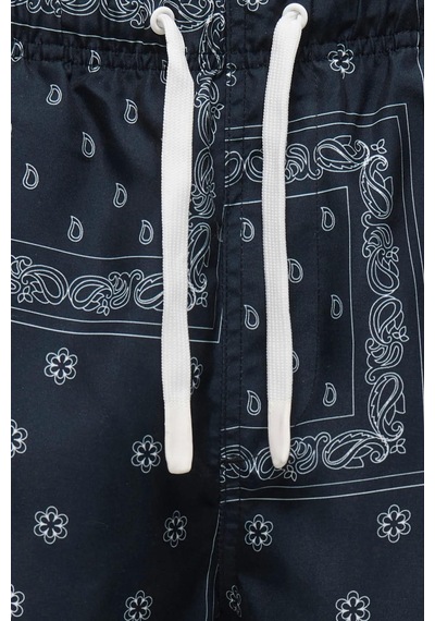 Only & Sons Onsbasıle Life Erkek Deniz Şortu Desenli Rahat Yazlık Regular Fit Siyah