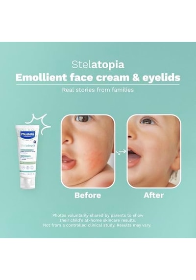 Stelatopia Emollient Yüz Kremi 40ml